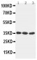 Anti-DKK-1 Antibody